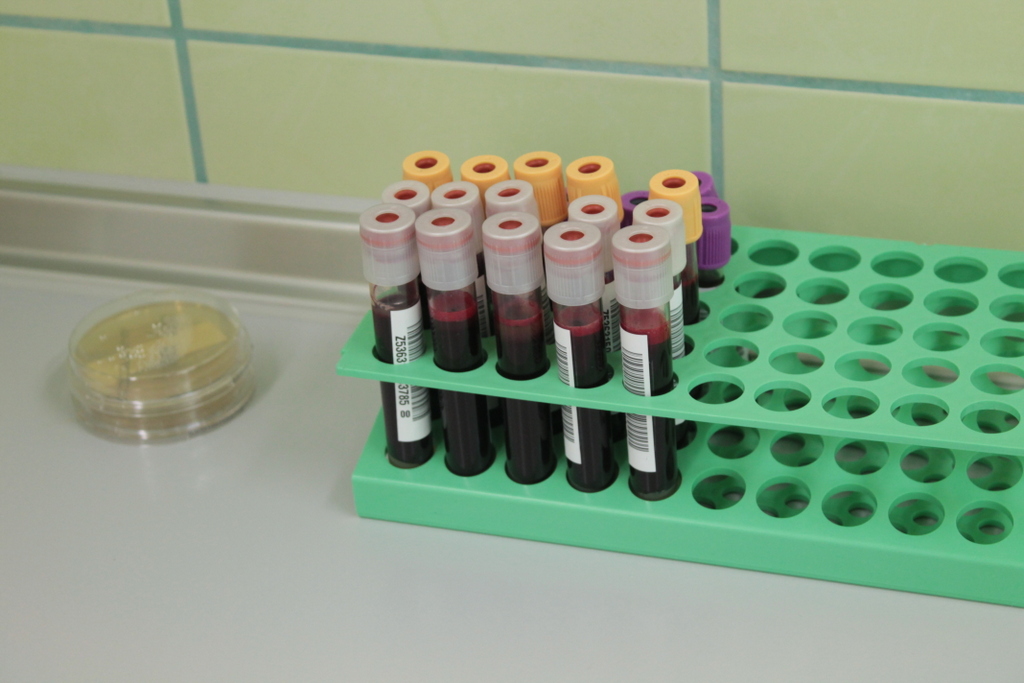 LUBIN. Szykują zapasy krwi na wakacje (FOTO, WIDEO)