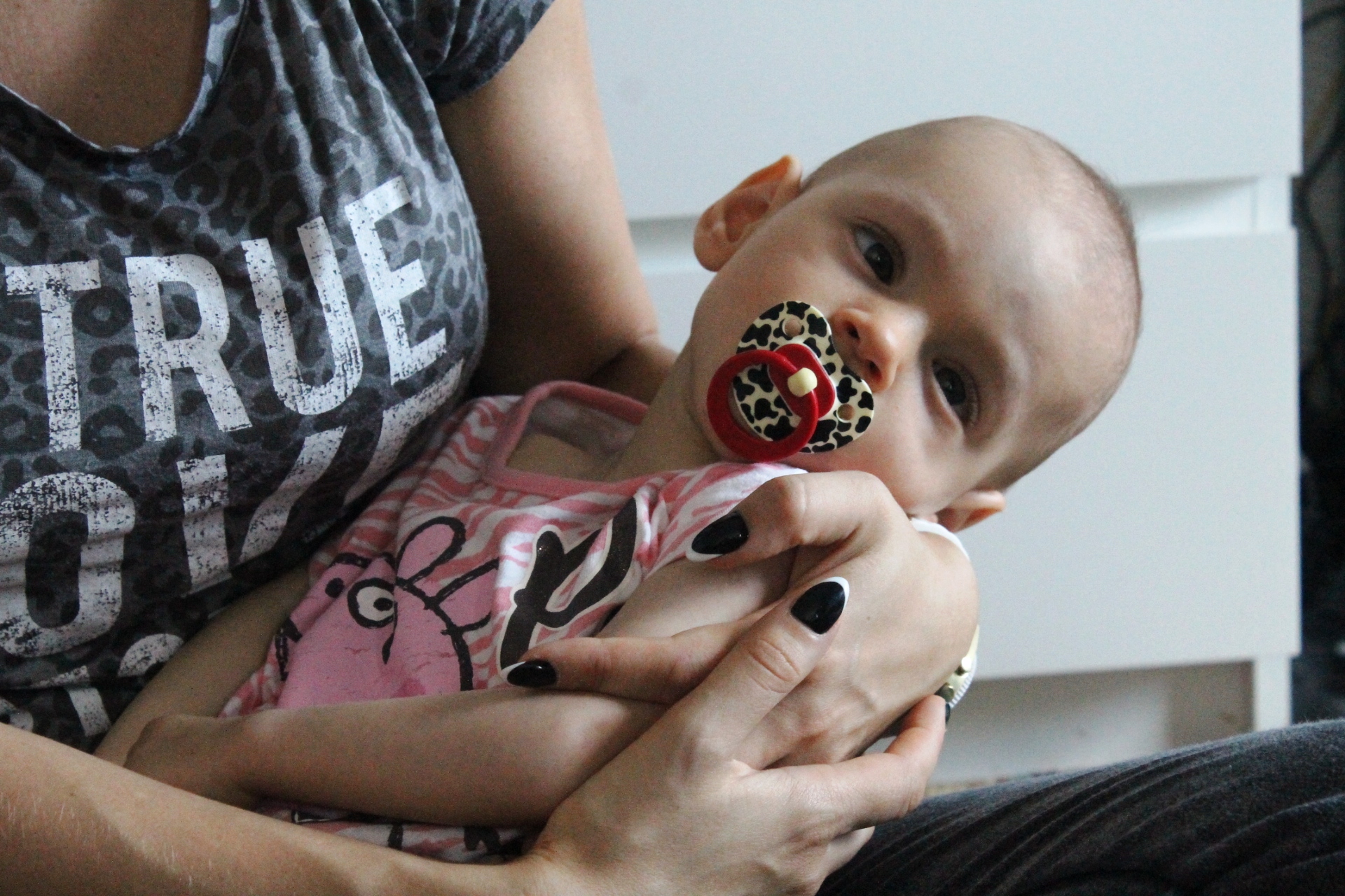 LUBIN. Malutka Blanka potrzebuje naszej pomocy/video/