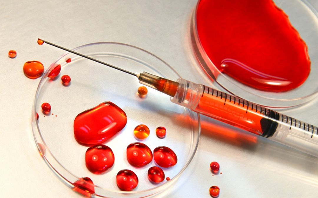 W sobotę zbiórka krwi w Polkowicach