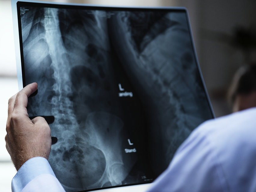 Głogowianie będą mogli zbadać płuca