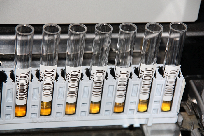 Więcej badań w legnickim szpitalu