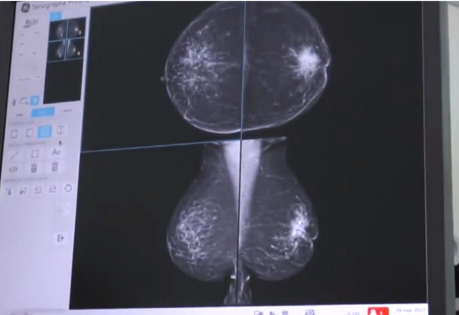 LUBIN. Akcja zakrojona na szeroką skalę!