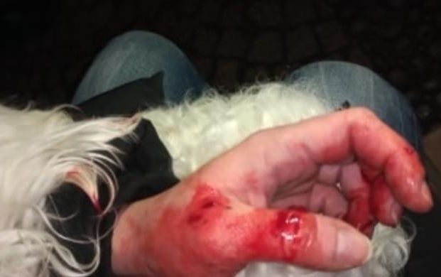 Amstaffy pogryzły sąsiadów (WIDEO)