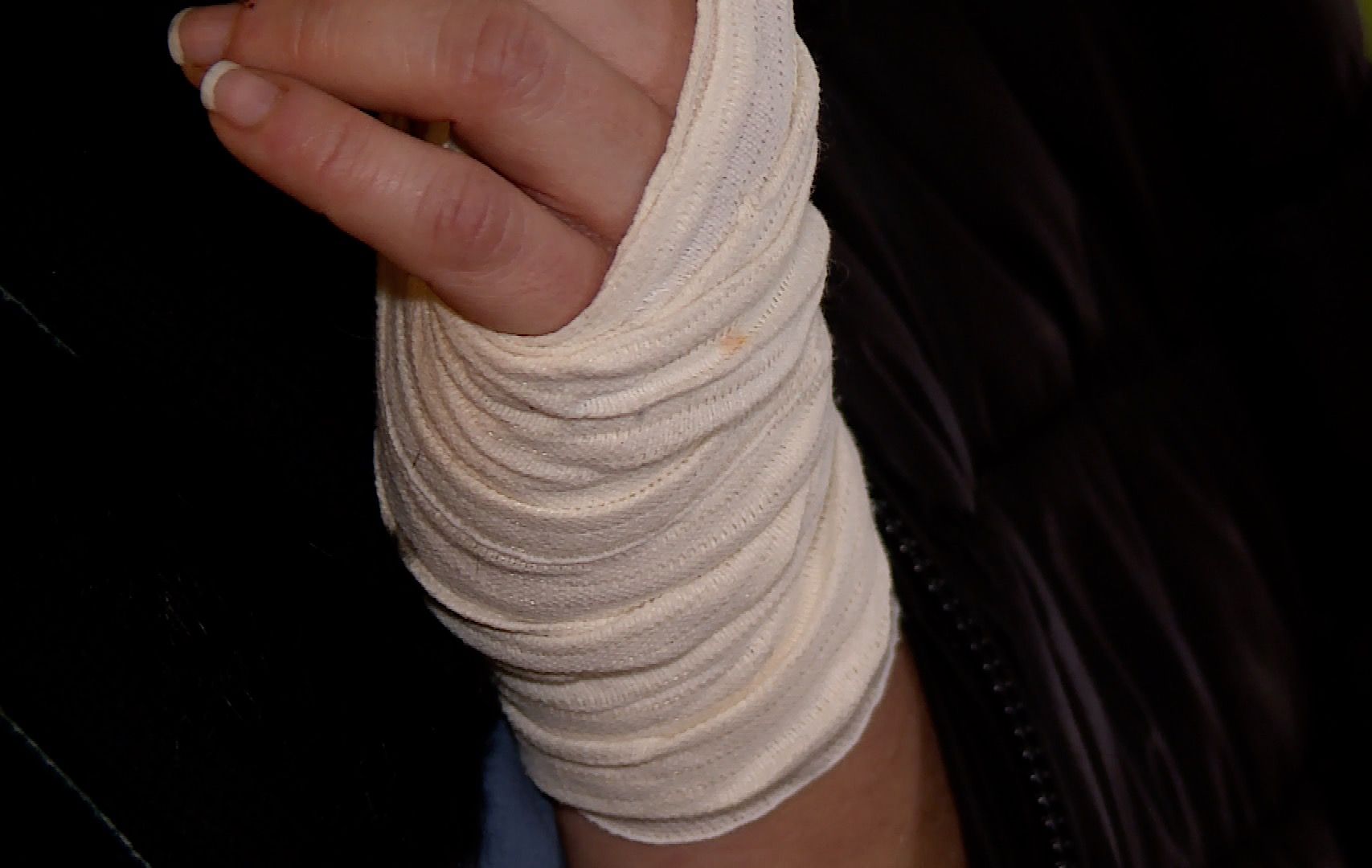 Psy, które pogryzły sąsiadów są… zdrowe! (WIDEO)